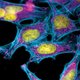 Hela cells dna 2.jpg  600x0 q85 upscale