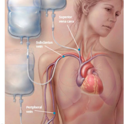 Timeline: Antecedentes históricos del soporte nutricional