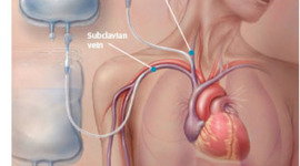 Timeline: Antecedentes históricos del soporte nutricional