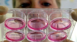 Timeline: L'enigma de la maladie d'Alzheiemr