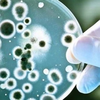 Timeline: Historia de la Microbiología