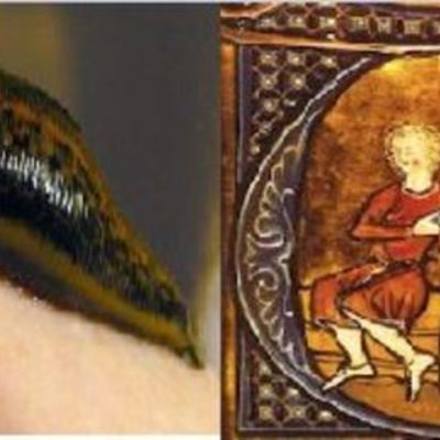 Timeline: Sangría y flebotomía.