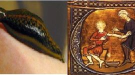 Timeline: Sangría y flebotomía.