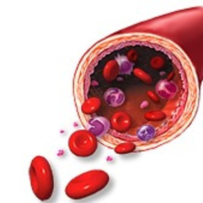 Timeline: La sangrías y la flebotomía