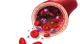 Timeline: La sangrías y la flebotomía