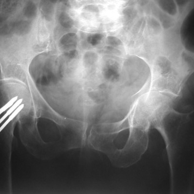 Timeline: Caso Clinico, Musculo Esqueletico