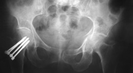 Timeline: Caso Clinico, Musculo Esqueletico