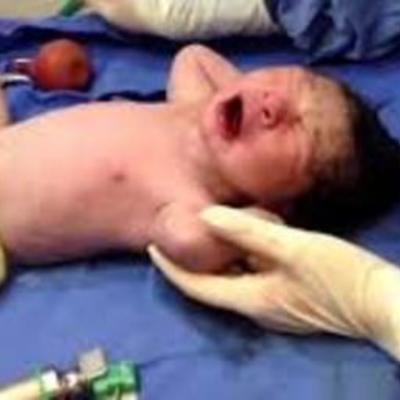 Timeline: Cuidados inmediatos del recién nacido en la sala de partos