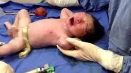 Timeline: Cuidados inmediatos del recién nacido en la sala de partos