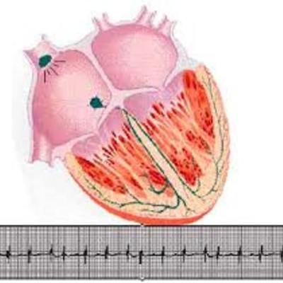 Timeline: Cronograma  proyecto Bloqueos Auriculoventriculares