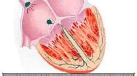 Timeline: Cronograma  proyecto Bloqueos Auriculoventriculares