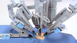 Timeline: Evolution of Medical Robots