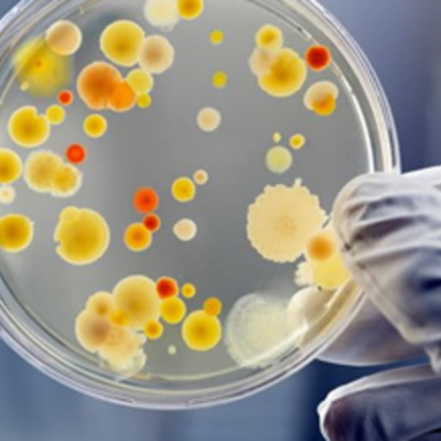 Timeline: HISTORIA DE LA MICROBIOLOGIA