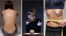 Timeline: Historia de la Anorexia