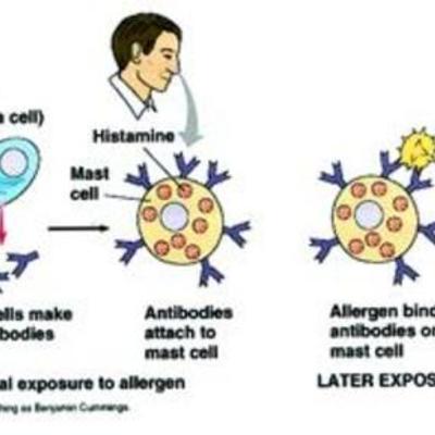 Timeline: Immune Response and Symptoms