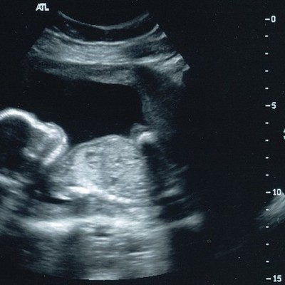 Timeline: Individual Life Cycle