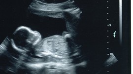 Timeline: Individual Life Cycle