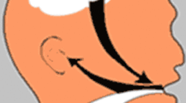 Timeline: Evaluación fonoaudiológica