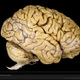 Human brain vis304784 lw