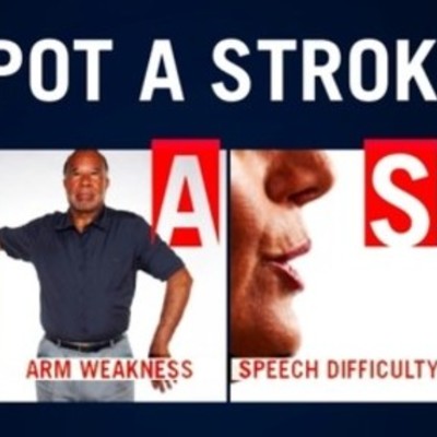 Timeline: Stroke: Signs, symptoms, investigations and treatment By Chloe Whitehead