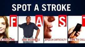 Timeline: Stroke: Signs, symptoms, investigations and treatment By Chloe Whitehead