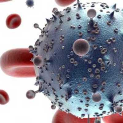 Timeline: A History of HIV