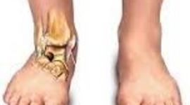 Timeline: Tiempos de reparación de los diversos tejidos: óseo, muscular, tendinoso y ligamentoso.