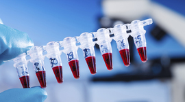 Timeline: Toxicology Timeline