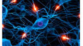 Timeline: Evolucion Redes