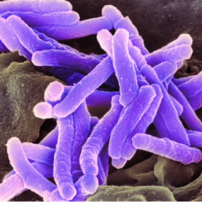 Timeline: A Tuberculose