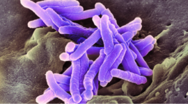 Timeline: A Tuberculose