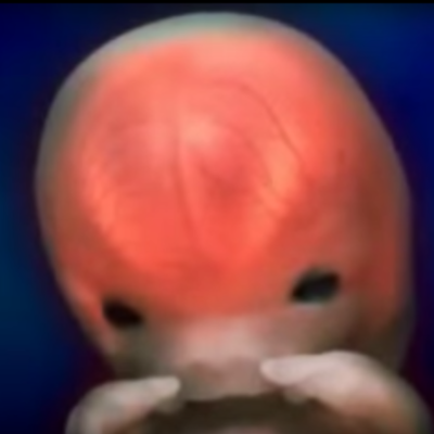 Timeline: Embryology of the Ear