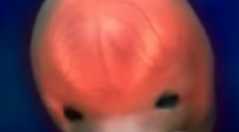 Timeline: Embryology of the Ear