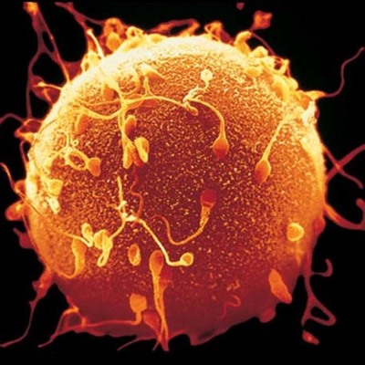 Timeline: Semanas del embarazo