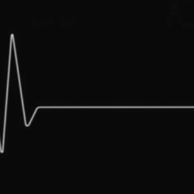 Timeline: 6.3b "My Death"