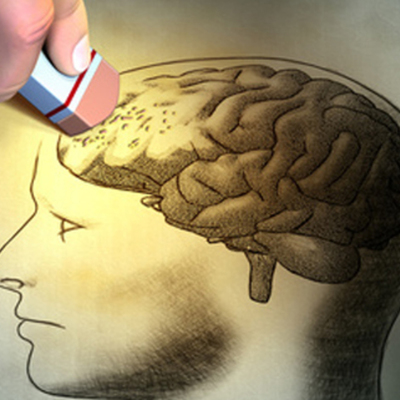 Timeline: Historia Alzheimer