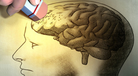 Timeline: Historia Alzheimer