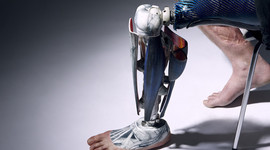 Timeline: 	prosthesis