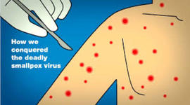 Timeline: Evolution of Small Pox