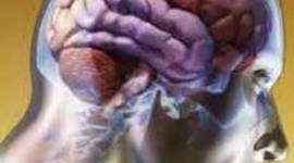 Timeline: HISTORIA DEL RETRASO MENTAL