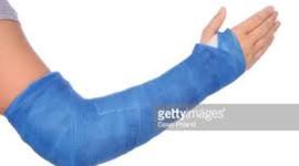 Timeline: breaking my arm