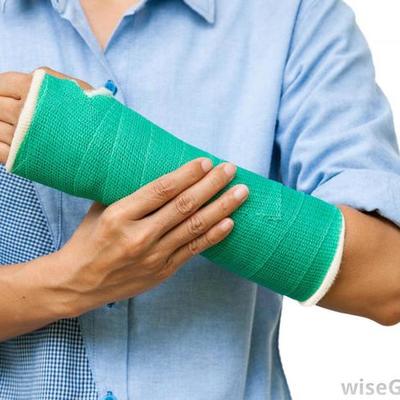 Timeline: broke my arm 2nd time