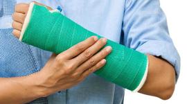 Timeline: broke my arm 2nd time