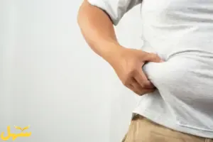 السمنة