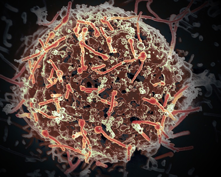 Ebola virus