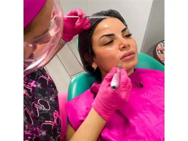 Tratamiento de Mesoterapia Piel Pink Glow a Domicilio RM