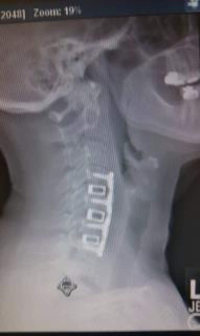 Lori Smith's album, New NECK!