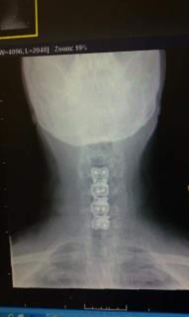 Lori Smith's album, New NECK!