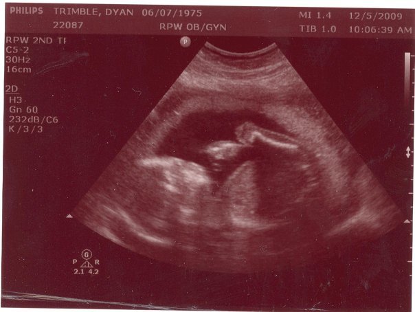 Dyan Trimble's album, Baby Trimble