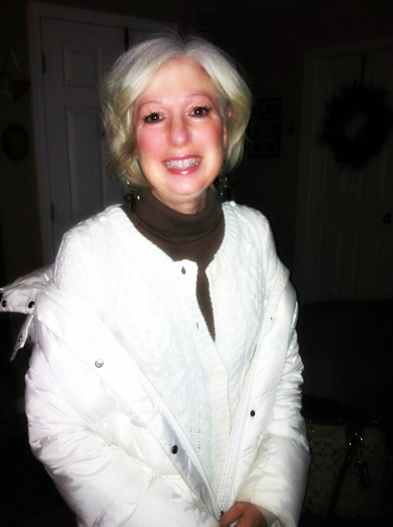 Joan Fewkes-Wise's album, Profile Pictures